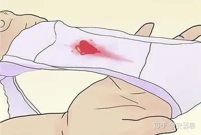 安安小课堂 怀孕着床出血持续几天 知乎