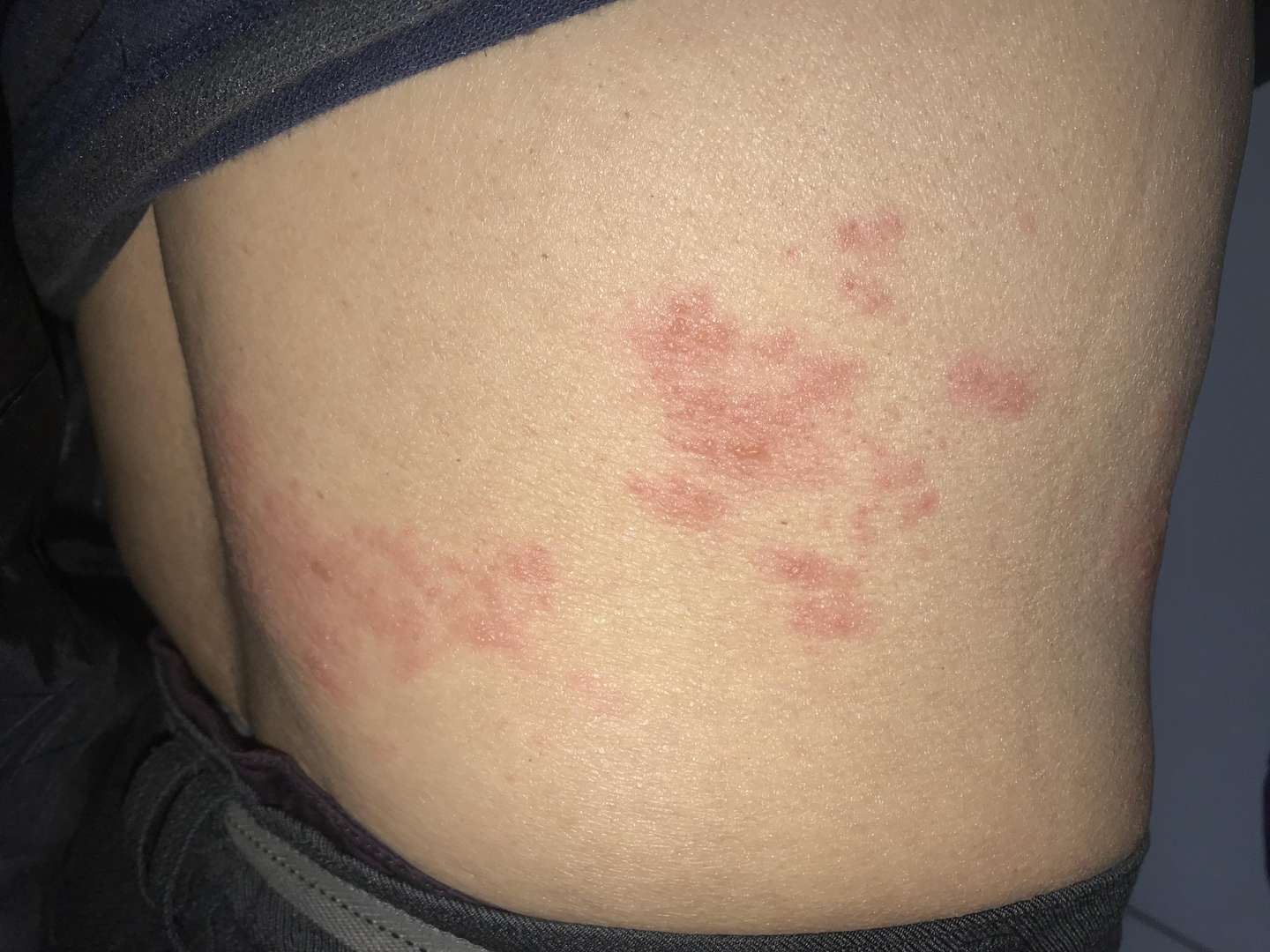 老人肚子突然大了起来 难道和缠腰蛇有关系 知乎