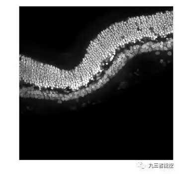 算法集锦(5)|医学图像的边缘检测|Python_边缘检测方法分割医学图像图-CSDN博客