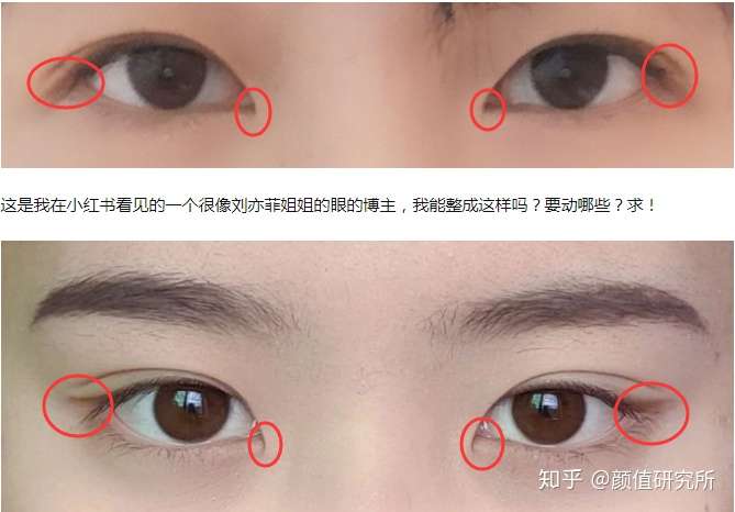 外眼角的话眼角下垂,需要改善,其次是双眼皮的宽度.