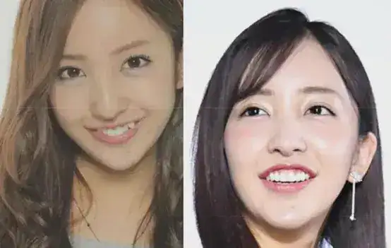 日本人的牙齿为何不整齐（日本人竟然都有这个习惯？）