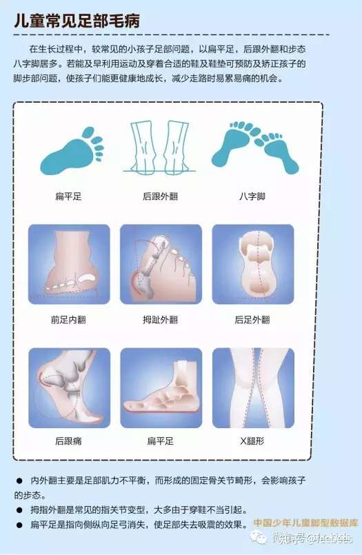 震惊 儿童少年健康脚型竟不足 知乎