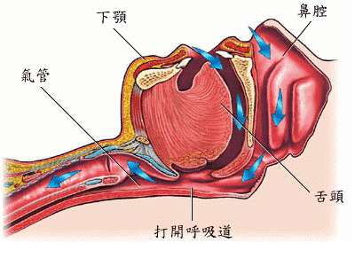 关于打呼噜该怎么治