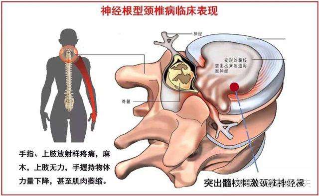 经常右臂膀痛可能是身体哪个地方出了问题 知乎