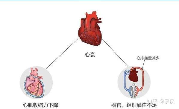 心衰患者血压控制在多少合适