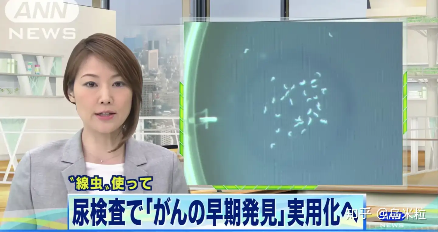 日本生物科技-如何用最简单高精度的方法早期发现肿瘤- 知乎