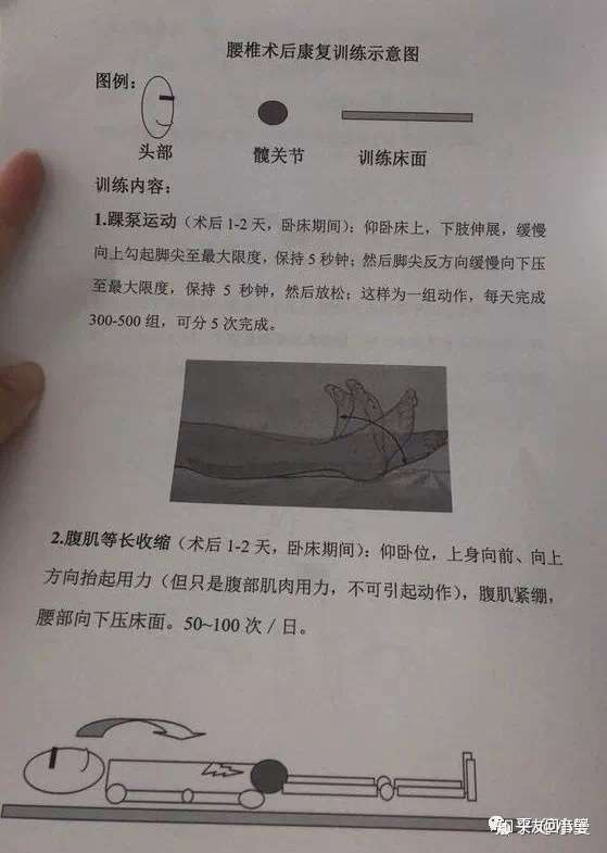 终于做了腰间盘突出微创手术了 知乎