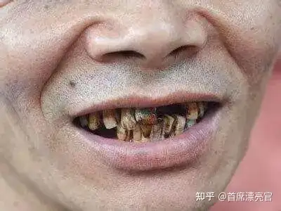 长期刷牙牙齿还是黄,想美白,应该怎么办?