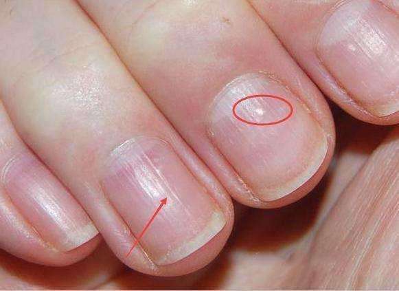 健康指甲的标准