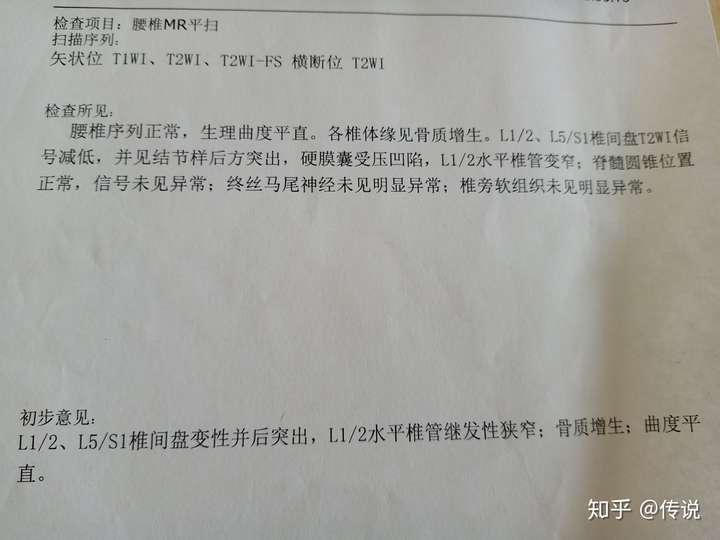 腰椎ct结果请大家帮我参考一下