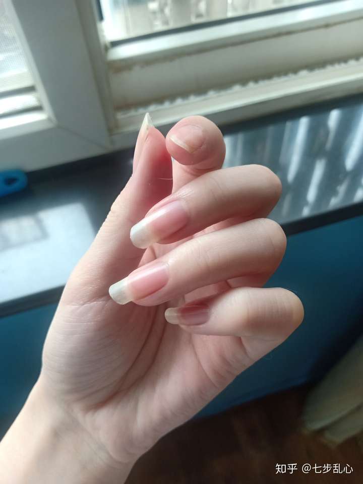 为什么我手指这么粗?有什么办法可以使其变细长?