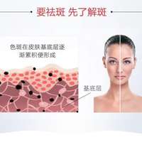 Mei美爱美 的想法: 要祛斑，先了解常见3种斑 | 雀斑 黄褐斑 … - 知乎