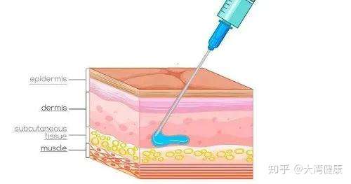 玻尿酸注射垫下巴可以维持多久呢