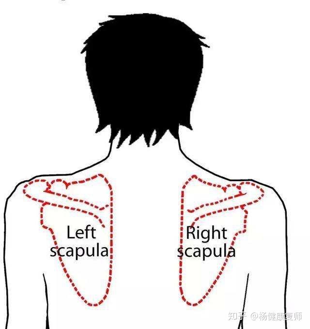 肺癌右肩痛位置图图片