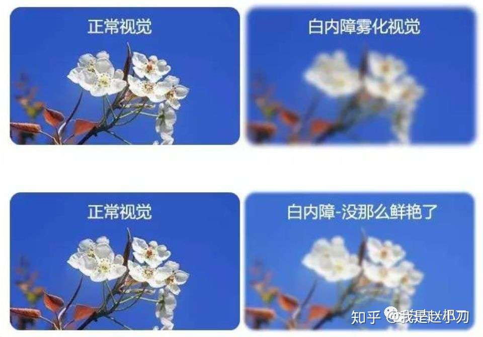 心疼 快4000度近视 从小幻想清晰到底是什么 知乎