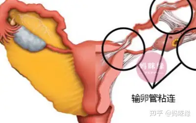 虚碟居袒？盆蒂煌蒙郊哮好“膀”酥悴！(图4)