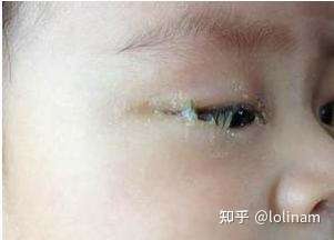 这要是真理,那赵雅芝,林志玲岂不是天天不洗脸,两眼 眵目糊就开始拍戏