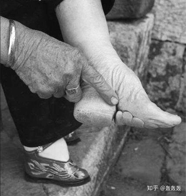 缠足后的脚有没有符合现代审美的图片?