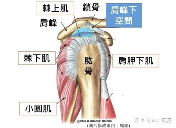 肩膀抬不起来 肩峰撞击综合症 知乎