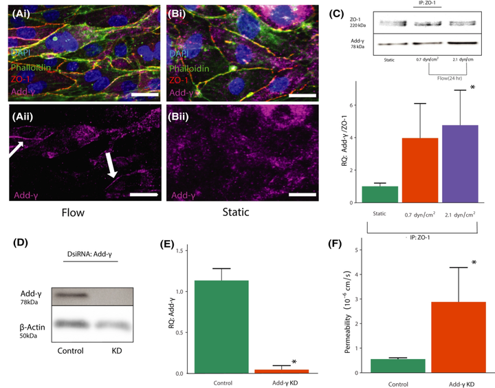 CD44 通过小 GTP 酶 RhoA 和 Rac1 介导体外血脑屏障模型中的剪切应力机械转导