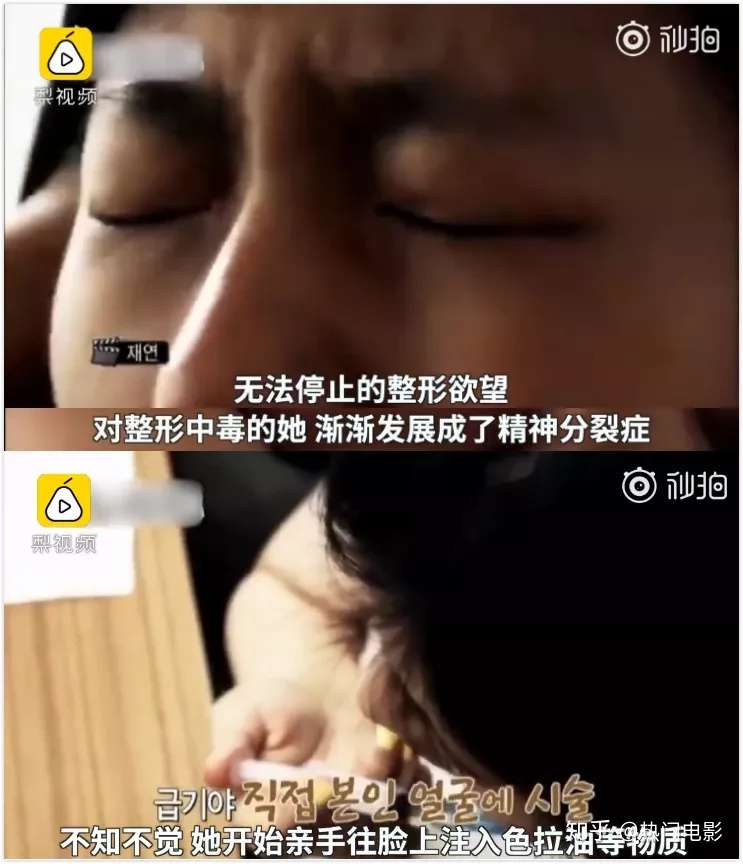 整容上瘾 把自己的人生整没了 知乎