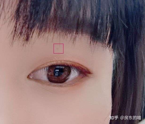 为什么有人说妖痣可怕妖痣究竟长在哪里