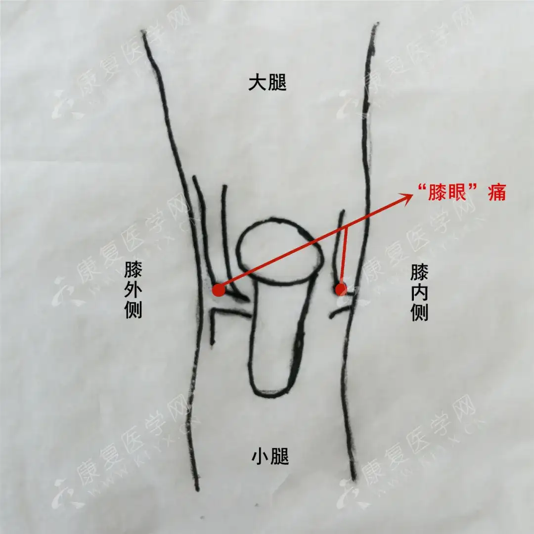 膝前痛 屈伸受限 是因为你的膝关节得了 肥胖症 知乎