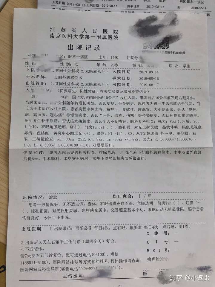 手术是在江苏省人民医院做哒,医生是董平主任,专门做斜视和美容这块哒