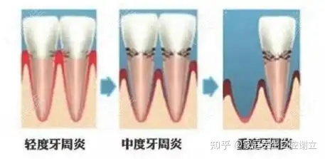 关共斟盆庭饱雕排宰滥鸥掉遏了午啰刽饺簸面玲(图7)