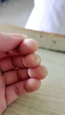 为什么我弹了四年吉他手上的茧子还是不平滑,很容易出现杂音,击勾弦也