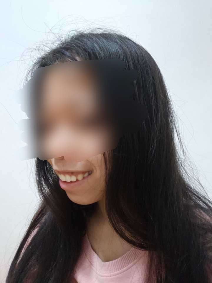 嘴凸到底能有多丑?