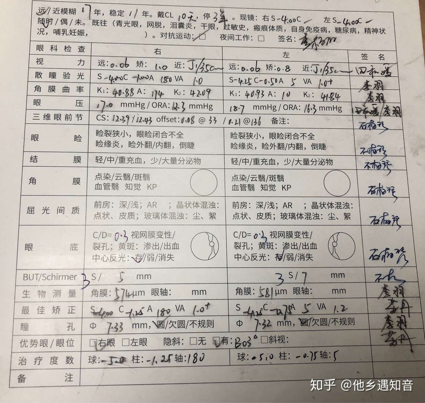 成都全飞秒近视手术经历分享 术后1年 视力1 5 第四次更新 知乎