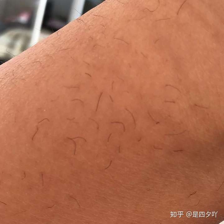 身体乳用了长腿毛怎么办(身体乳用了长腿毛怎么办啊)