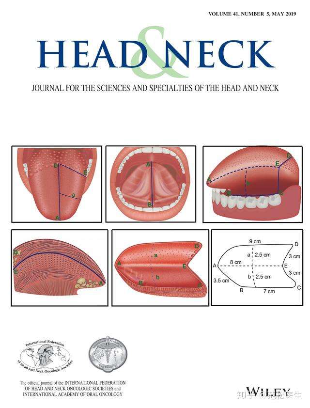 如何解决舌癌患者手术治疗后的功能恢复 最新研究 知乎