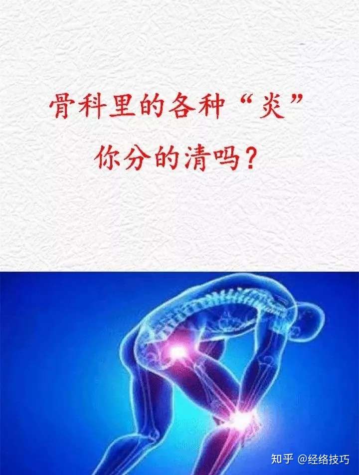 如何分辨滑膜炎 骨膜炎 滑囊炎 腱鞘炎 筋膜炎 知乎