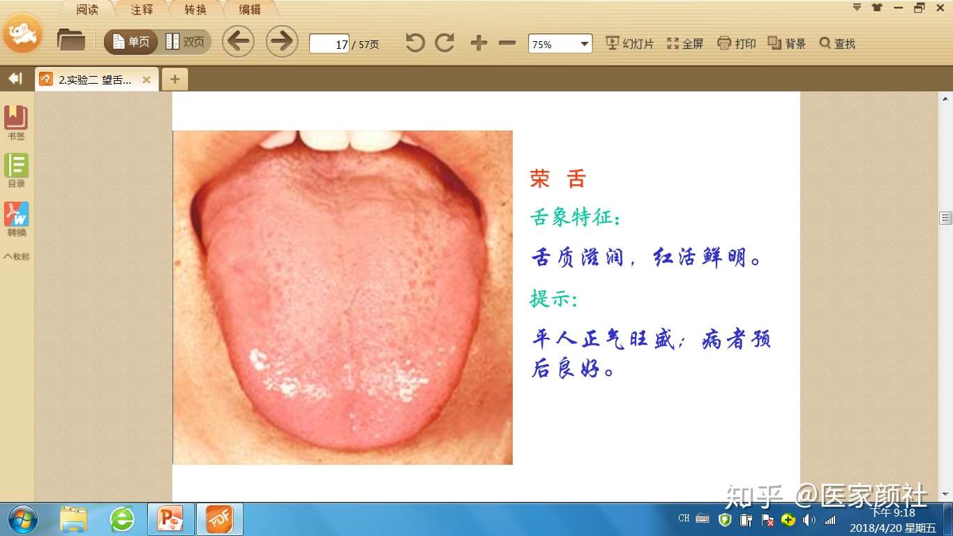 如何通过舌苔来判断身体健康与否 最全舌像来了 一分钟教你学会所有舌像 知乎