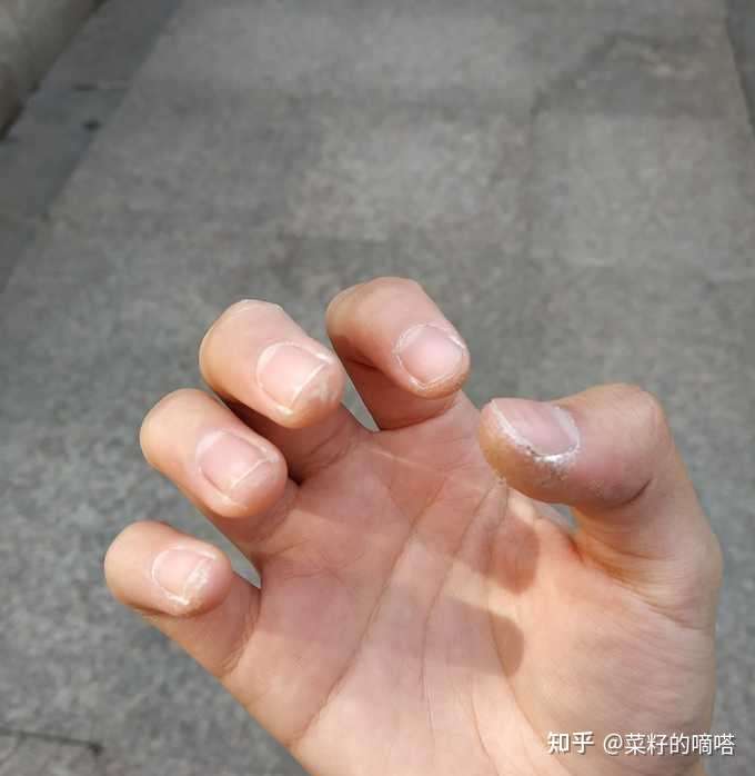 长期练钢琴手会变丑吗?