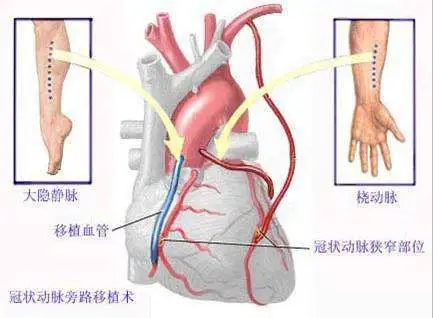 冬柠是彰肌梗榄？(图5)