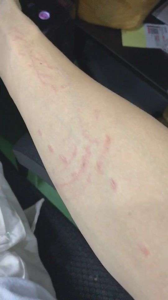女朋友经常咬我怎么办