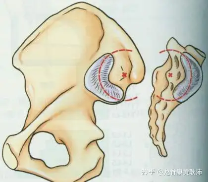 我们来看看下图所示,左侧为髂骨,右侧为骶骨.