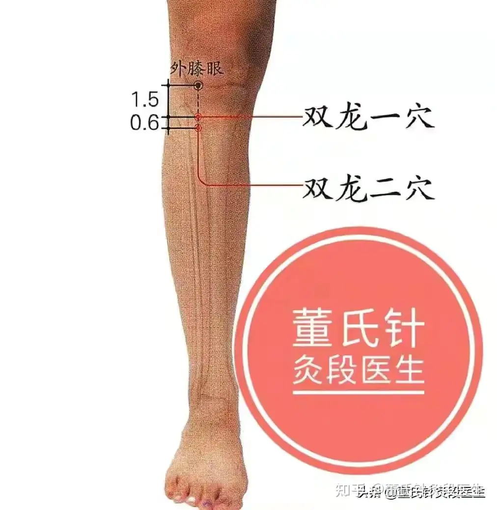 董氏针灸不外传之绝针双龙穴分享给大家- 知乎