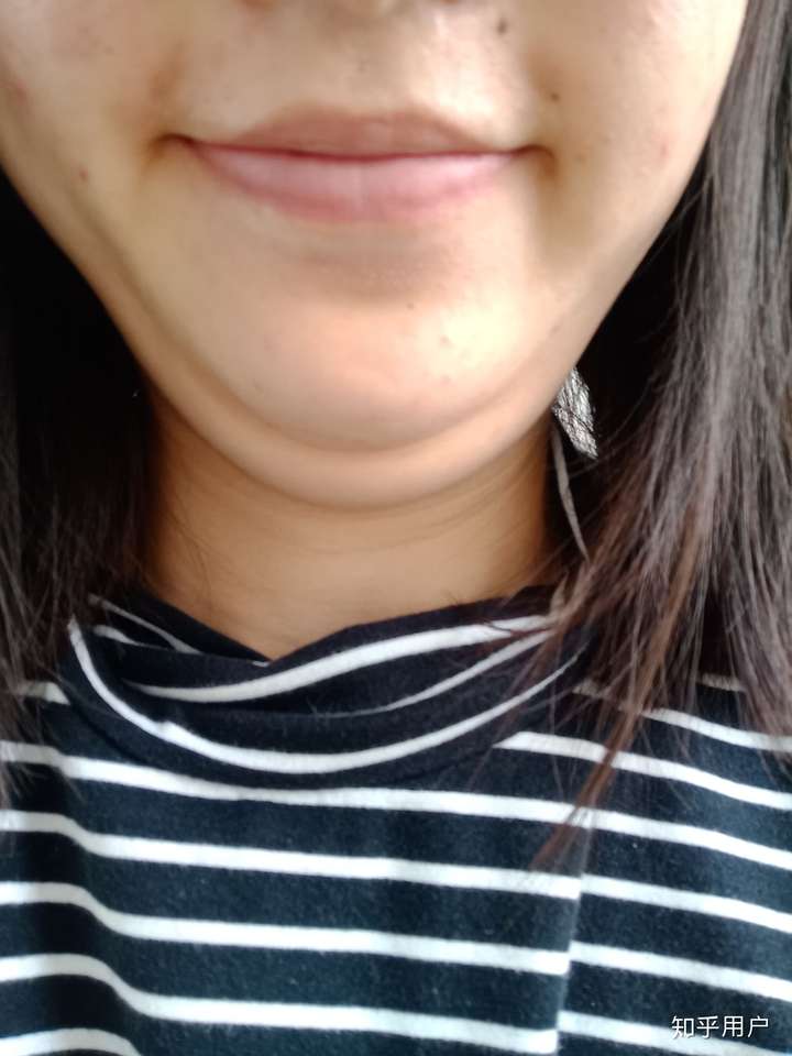 双下巴是一种怎样的体验?