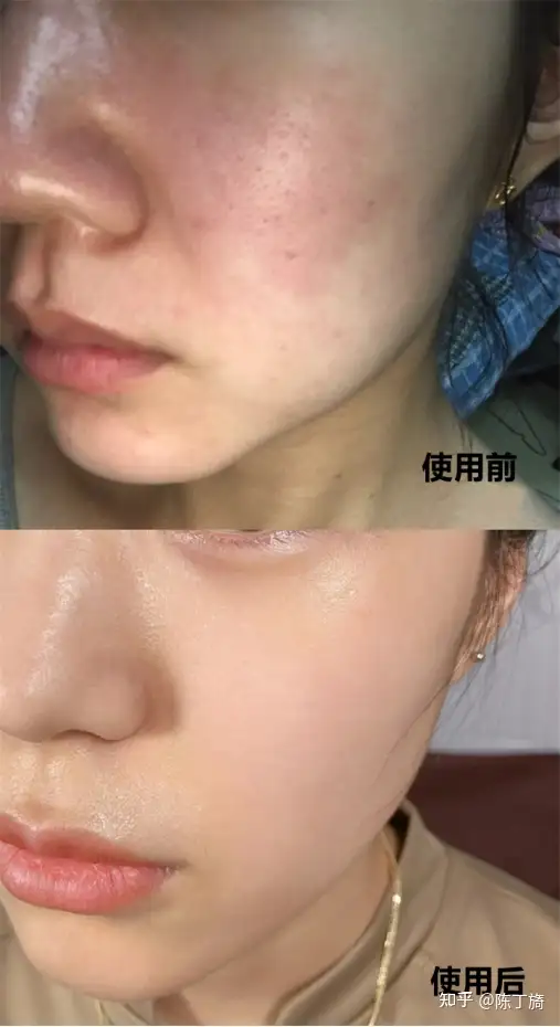 敏感肌换季自救指南!2021那些“真香”的敏感肌修护产品合集!!拒绝脸红
