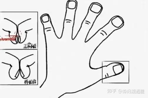 杵状指（杵状指的主要原因）