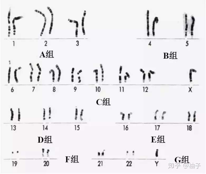 染色体检查报告怎么看 知乎