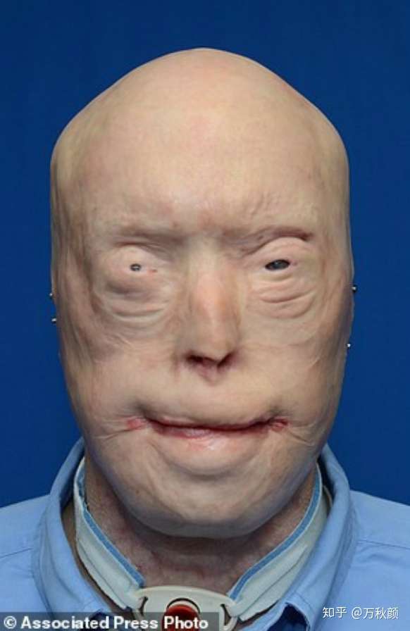 整容的极限是什么?