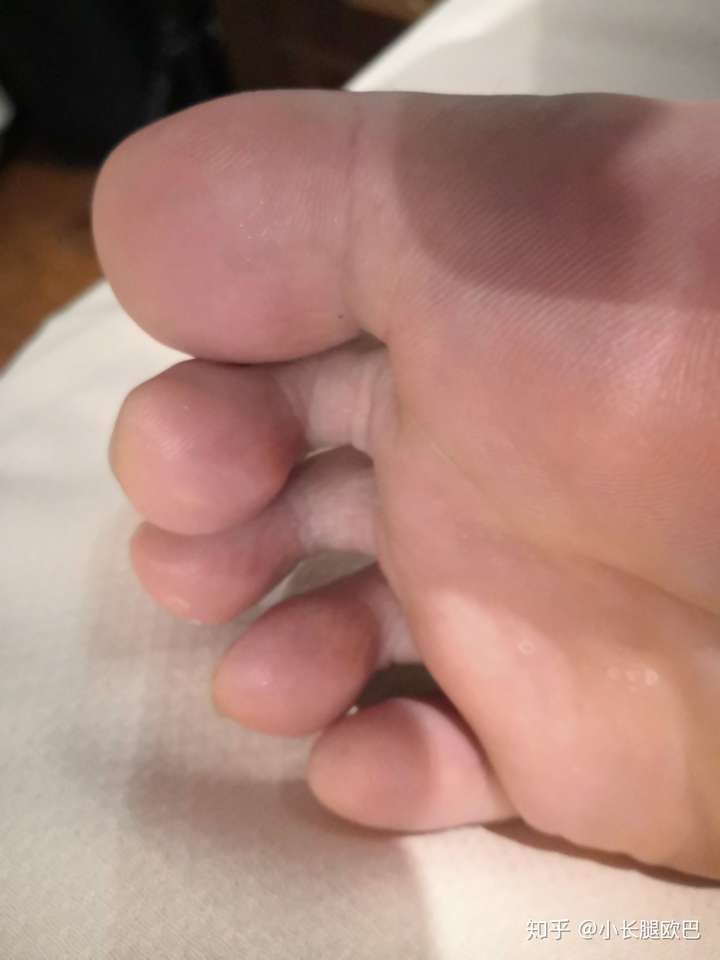 闲着无聊好奇大家的大脚趾指纹都长啥样啊哈哈哈哈哈男生女生都可以发