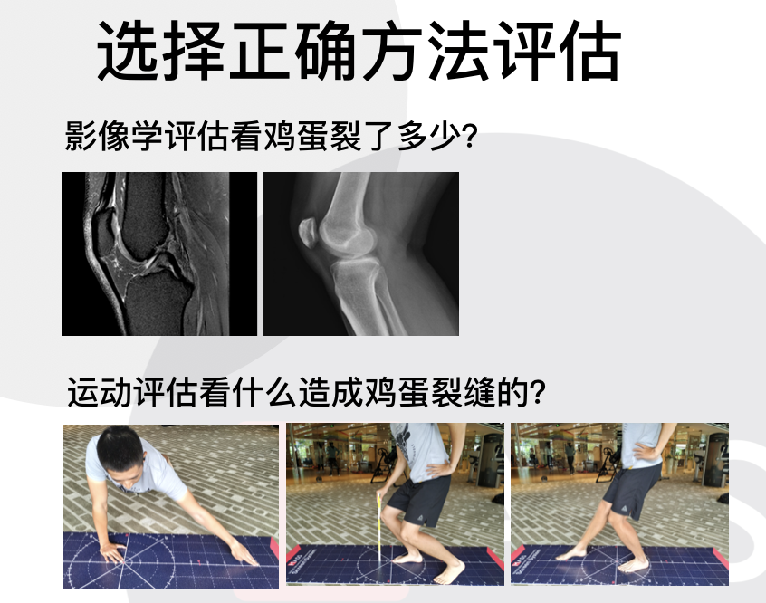 半月板损伤后为什么一定要做运动康复 知乎