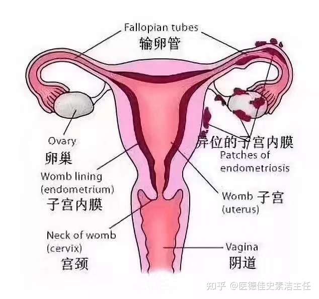 子宫在人体位置图解图片