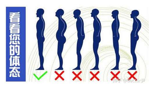 她们嘴里的"  肚 子 大",原来是不良体态 —— 骨盆前倾,腰椎前凸.